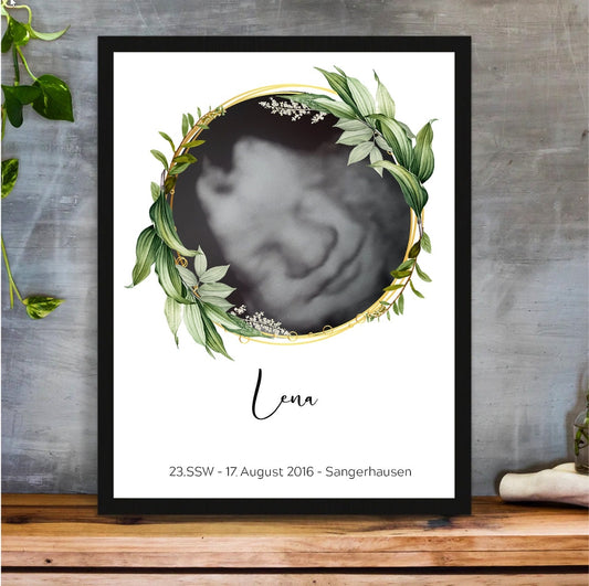 Schwangerschaft Ultraschallbild - YP Design